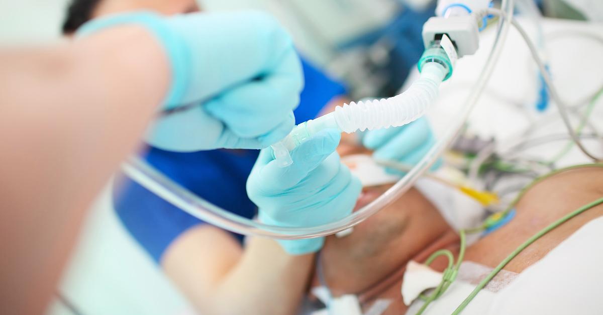 Viele beatmete Covid-19-Patienten sterben - US-Ärzte schlagen Alternativen vor